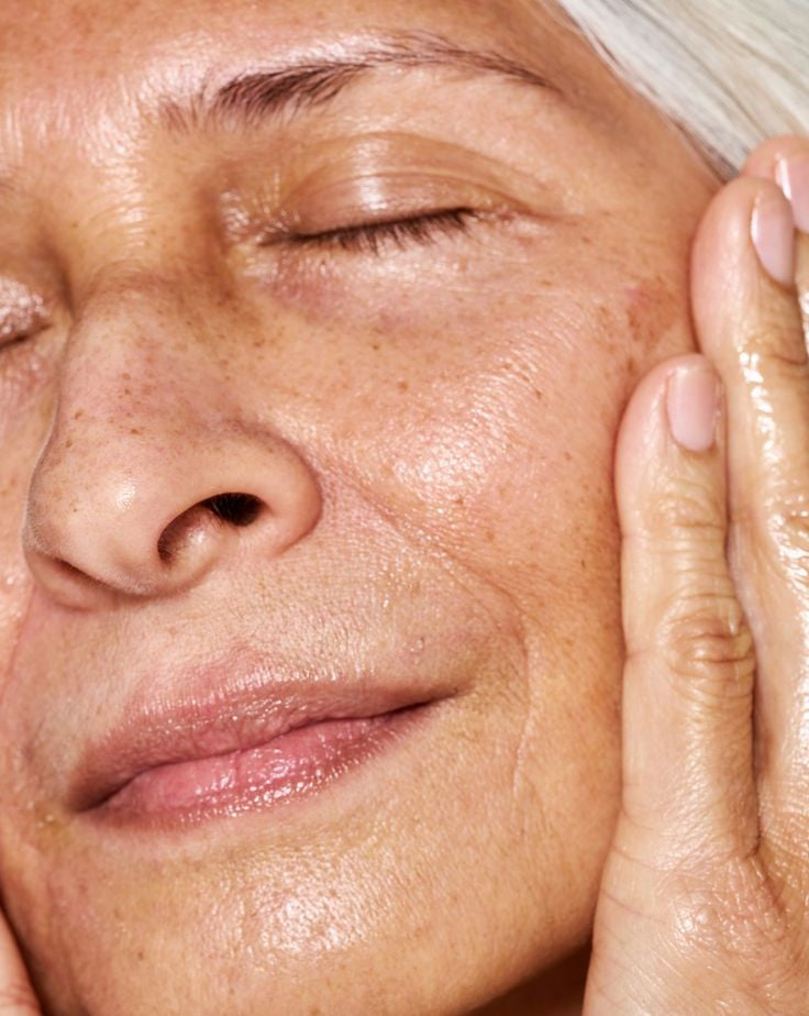 fine lines / wrinkles